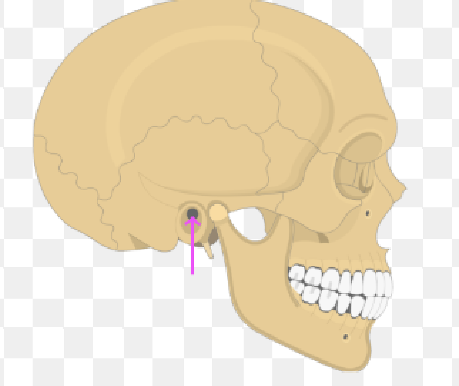 <p>What bone marking is this?</p>