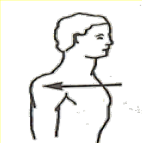 <p>What Movement is occurring?</p>