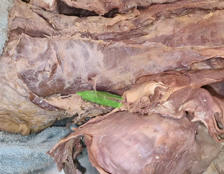 <p>green highlight?</p>