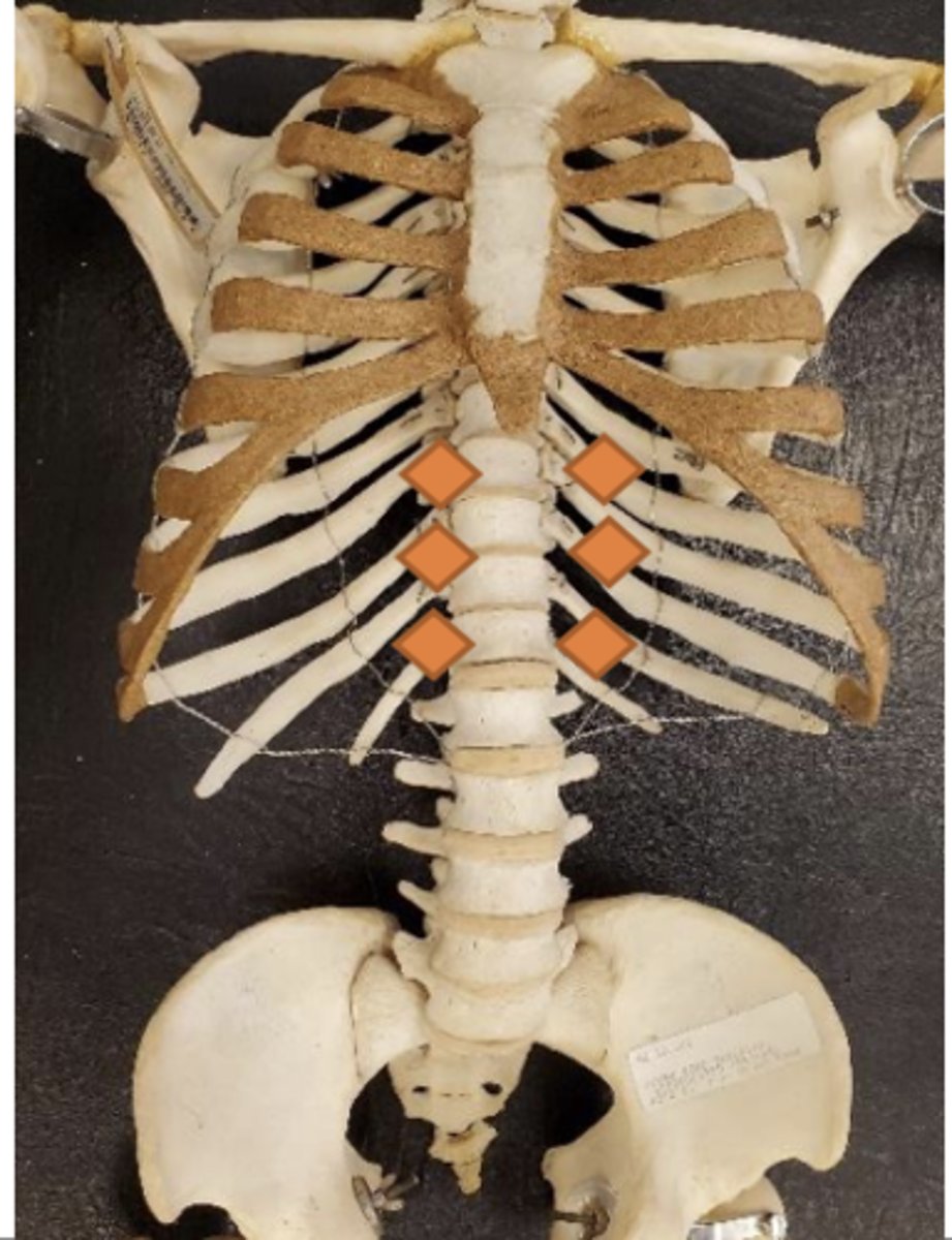 <p>1/4 distance between xiphoid and umbilicus</p><p>(technically there's three, the one midline at end of xiphoid and two lateral and slightly inferior)</p>