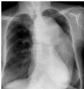 <p>what is this? and what causes it</p>