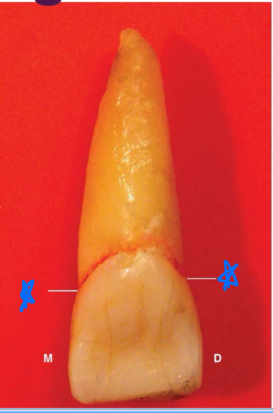 <p>Mesial</p>