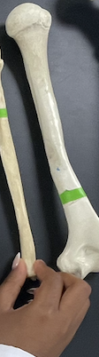 <p>Name this Bone?</p>