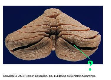 <p><span><span>Identify the indicated groove of the cerebellum</span></span></p>