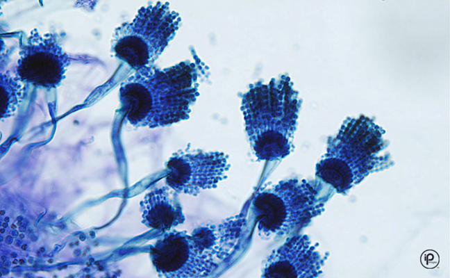 <p>Hyaline/Septate</p><p>Blue-green/white</p><p><em>Uniseriate phialides</em> on upper ½ to 2/3 of vesicle, round conidia </p><p>Most frequent isolated <em>Aspergillus spp.</em></p>