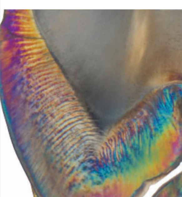 <ul><li><p>A set of <strong>10 or more layers of enamel rods</strong> composes the <strong>Hunter–Schreger Bands (HSBs)</strong>.</p></li><li><p>HSBs are due to the <strong>synchronous decussation of enamel rods in the horizontal plane</strong> and are probably caused by the reflection of light by the <strong>interprismatic material</strong>.</p></li><li><p>They are most concentrated in regions exposed to greater demand, such as:</p></li><li><p>The <strong>occlusal surfaces of posterior teeth</strong> (for chewing forces)</p></li></ul><ul><li><p>The <strong>surfaces of maxillary and mandibular canines</strong> (for guiding mandibular movement)</p></li></ul><p></p>