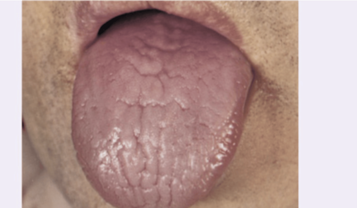 <p>Diagnosis?</p>