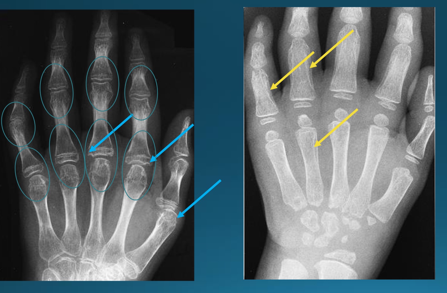 <p>what is the diagnosis?</p>