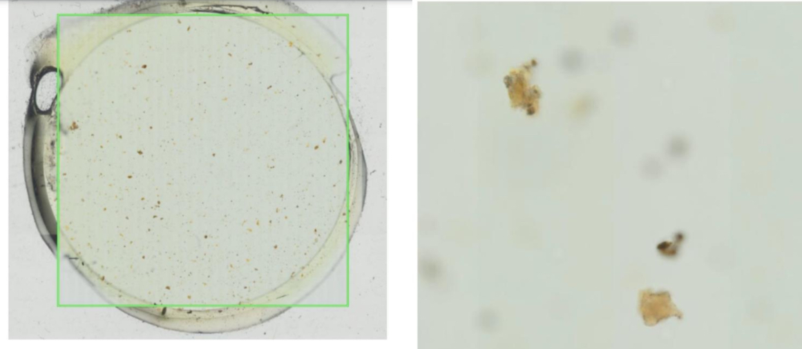 <p>Roztocze kurzu domowego - osobnik dojrzały (Dermatophagoides pteronyssinus)</p>