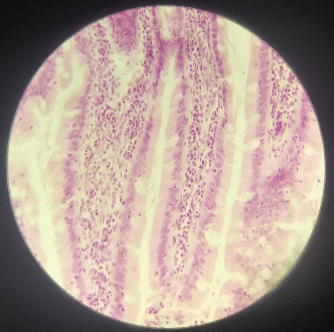 term image