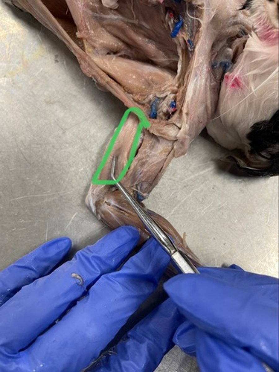 <p>O: humerus; scapula</p><p>I: olecranon process of ulna</p><p>A: extends elbow</p>