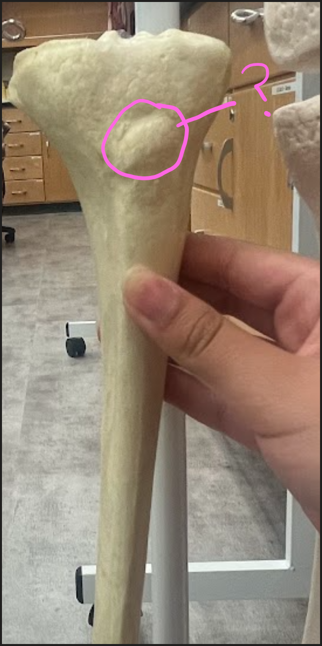 <p>What is this circled region?</p>