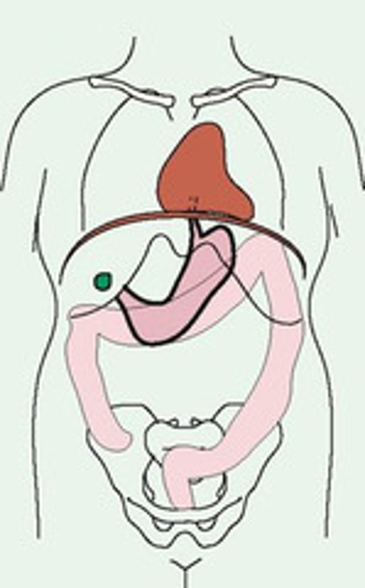 <p>Hypersthenic</p>