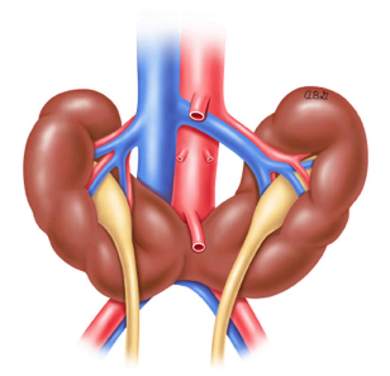 <p>MC renal fusion abnormality occurring in 5th-9th week</p><p>most fuse at lower poles</p><p>2 separate excretory renal units and ureters remain</p><p>isthmus can be of renal parenchyma or a fibrous band</p><p>asymptomatic or complications later in life</p>
