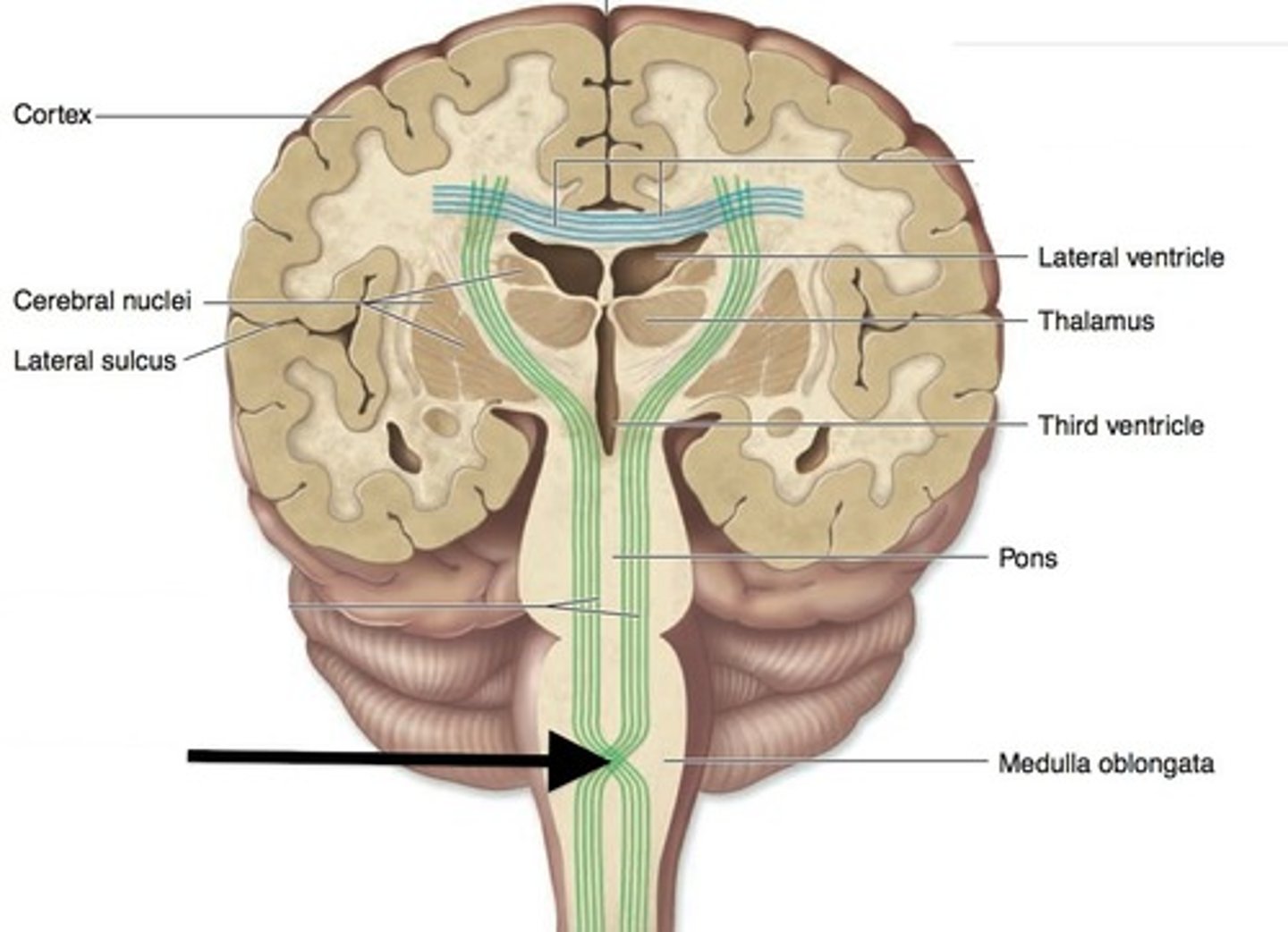 <p>cross over point for the tracts passing through the medulla</p><p>It occurs at the level of the medulla oblongata, which means that some of the motor fibers that originate in the CNS will cross to the opposite side of the brain.</p><p>This explains why when there is a stroke on one side of the brain, paralysis will result on the opposite side of the bod</p>