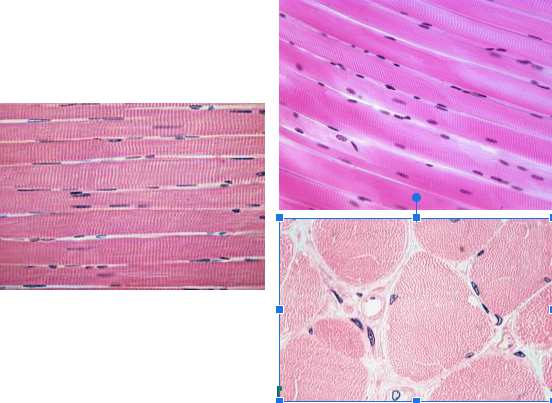 <ul><li><p>Characteristic: </p><ul><li><p><strong>VOLUNTARY </strong></p></li><li><p><strong>MULTINUCLEATE</strong></p></li><li><p><strong>STRIATIONS</strong></p></li></ul></li><li><p>Location: <strong>Attaches to bones</strong> to move the body</p></li><li><p>Function: <strong>Contract to produce body movements</strong></p></li></ul><p></p><p>Looks more CLEAN and <strong>NOT BRANCHY LOOKING</strong></p>