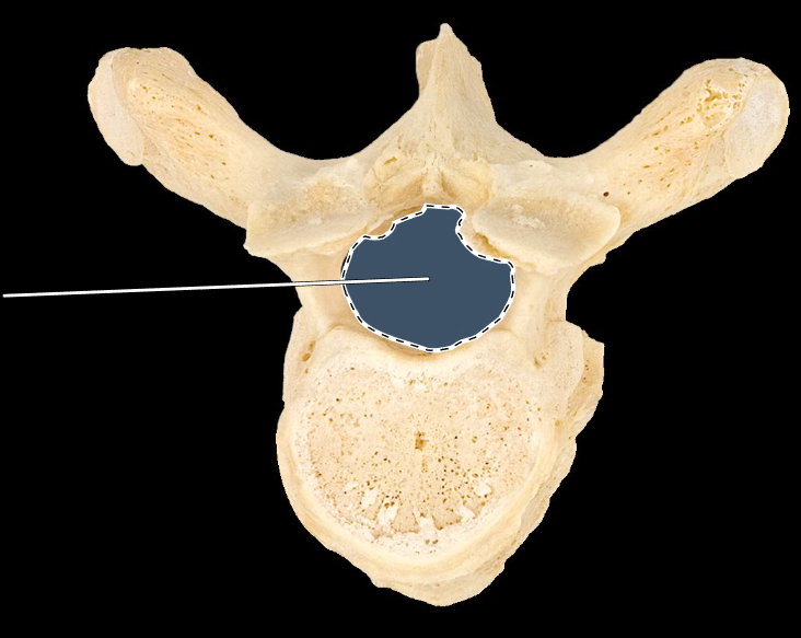 <p>What part of the vertebra is highlighted?</p><p>What type of vertebra is this (which region is this vertebra from)?</p><p>(Superior view).</p>