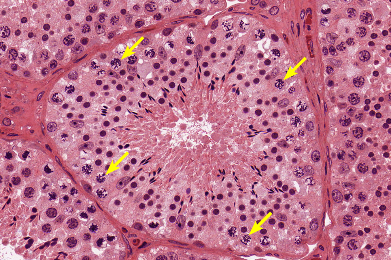 <p>histo; large nucelus, but starting to break apart, can see little dots in the nucleus</p>