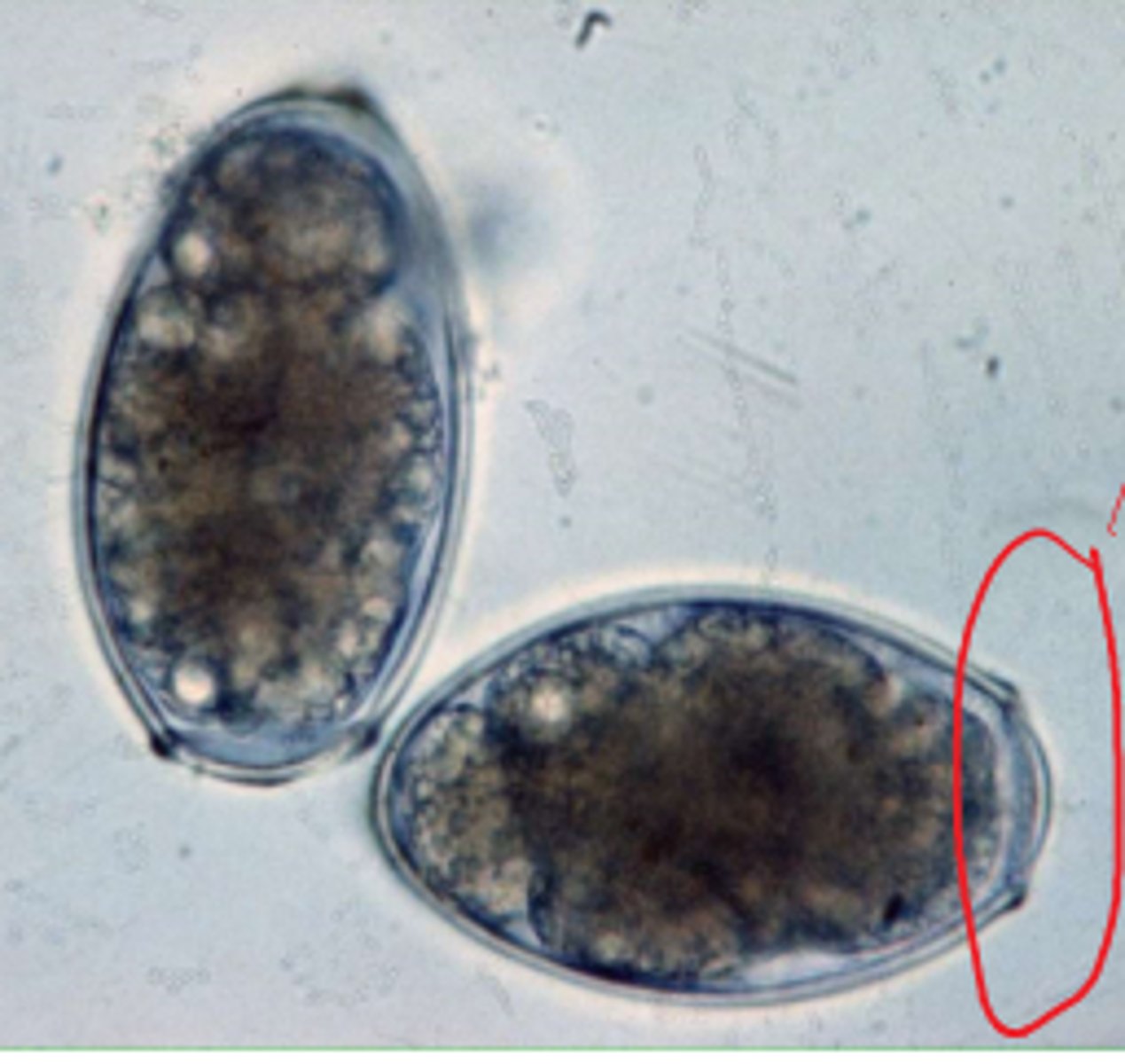 <p>lung fluke</p>