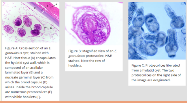 <p><span>x-rays, ultrasound or CT scan</span><br><span>4 serology tests, ELISA</span><br><span>4 presence of scolices, Hydatid sand or daughter</span><br><span>cysts</span></p>