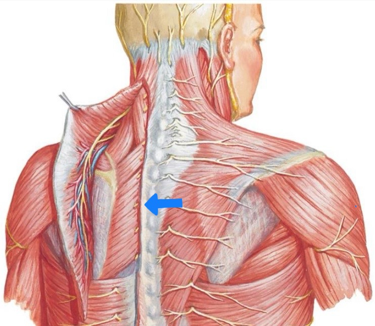 <p>Rhomboid Major</p>