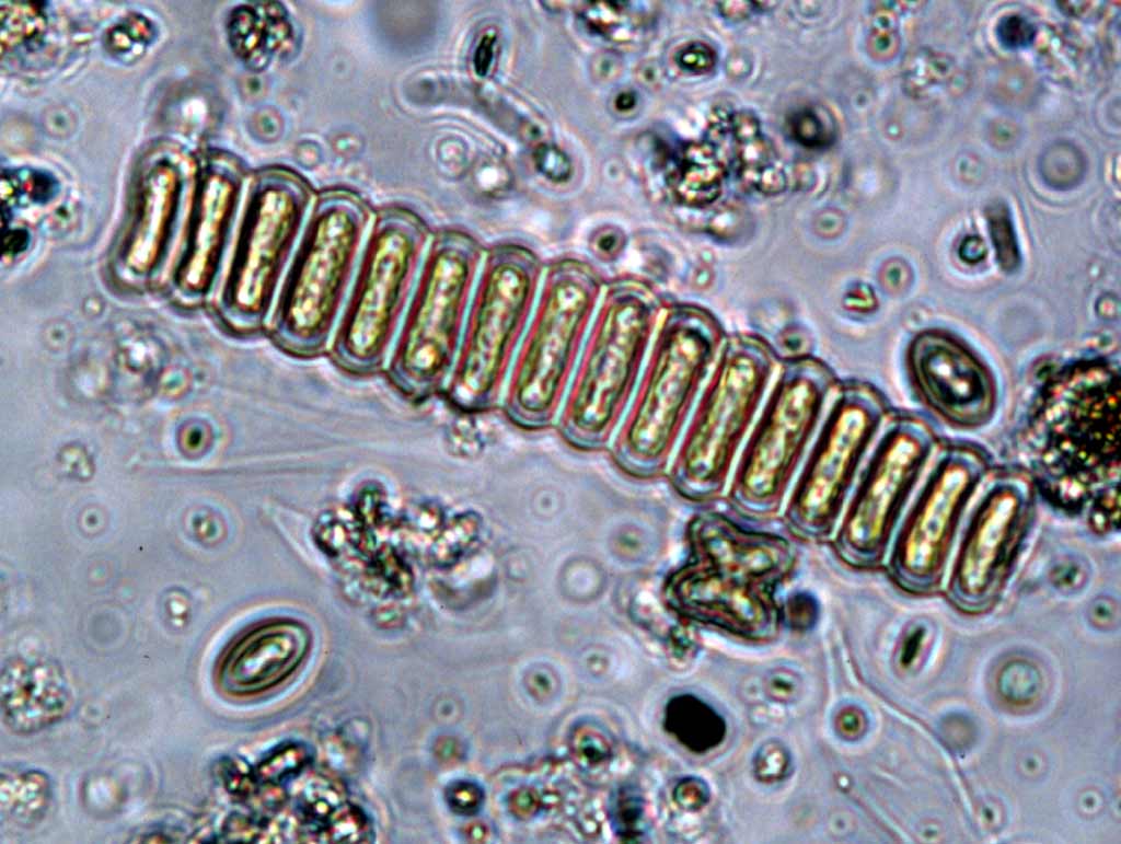 <p>Scenedesmus</p><p>chlorophyta</p><p>green</p><p>cylindrical;ovoid;fusiform;lunate</p><p>aligned in a single row side by side</p><p>non-motile; no flagella</p><p><span>rigid, multi-layered cell wall with ornamentation (ridges, warts, spines); efficient at removing nitrogen and phosphorus from wastewater</span></p>