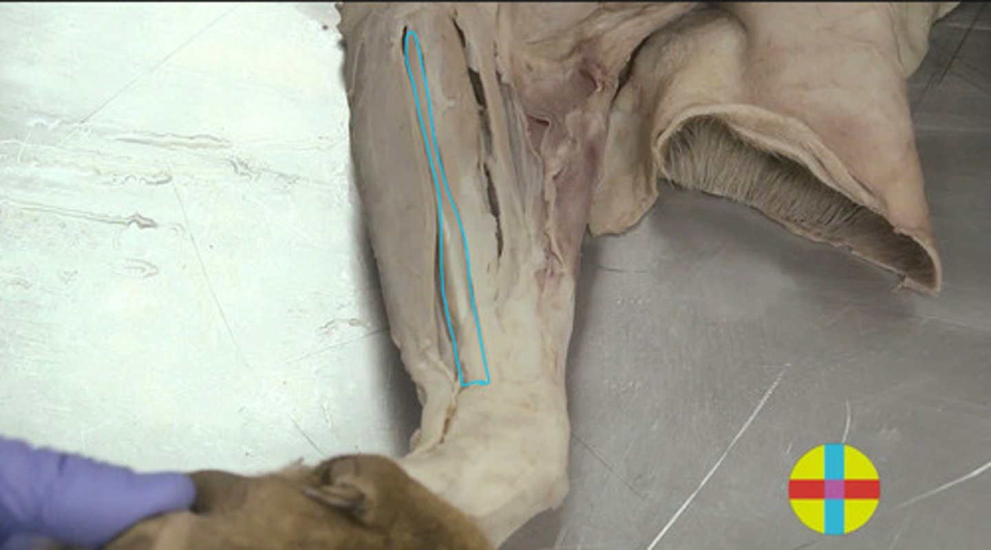 <p>Origen: epicóndilo md húmero, radio y cúbito. Tres cabezas: humeral, cubital y radial</p><p>- &nbsp;Retináculo flexores.</p><p>- &nbsp;Eq: lig accesorio</p><p>Inserción: cara flexora 3a falange. Bolsa podotroclear.</p><p>Función: Flexor carpo y de los dedos. Estabilizador del menudillo. Extensor</p><p>del codo</p><p>Inervación: N. mediano y cubital</p>