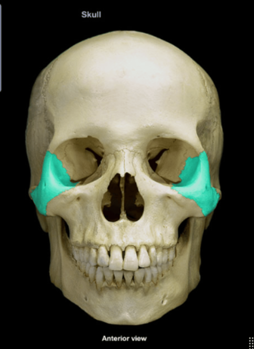 <p>Cheekbone, contributing to the eye socket.</p>