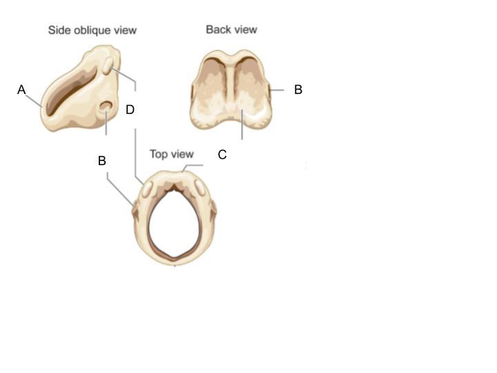 <p>D</p>