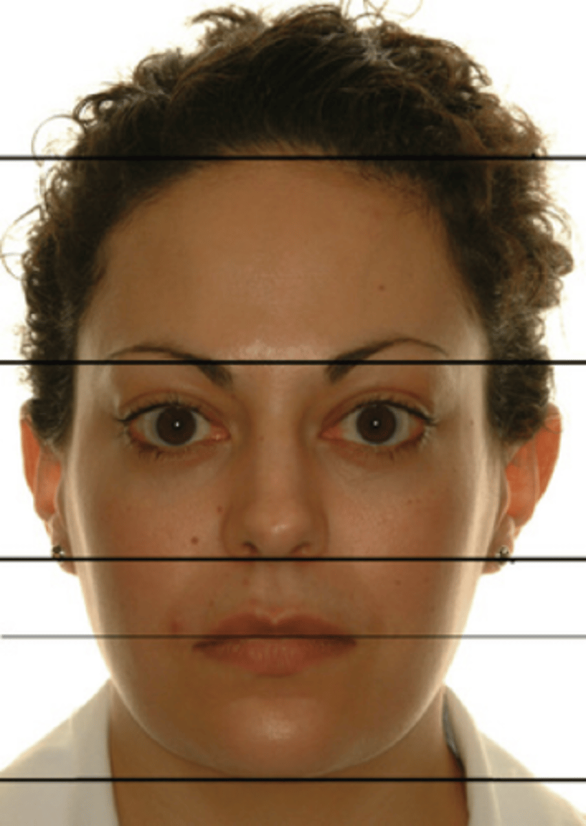 <p>3 horizontal sections</p>