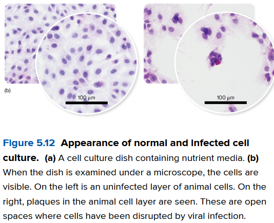 <p>Be able to explain what plaques are and why you would look for them in cell culture</p>