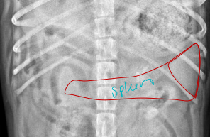 <ul><li><p>Left side next to stomach</p></li><li><p>big, mobile, smooth</p></li><li><p><strong>Hyperechoic</strong> than both the <strong>liver or renal</strong> cortex&nbsp;</p><ul><li><p><strong>SLinKy </strong>: brightness of organs</p></li></ul></li><li><p>hyperechoic fat near hilus</p></li></ul><p></p>