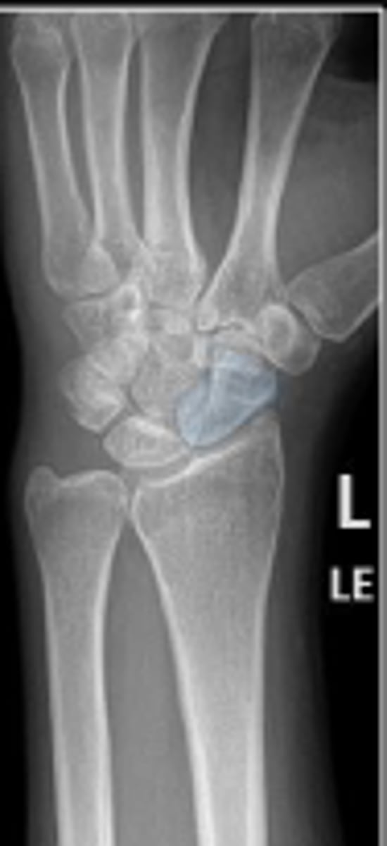 <p>What is outlined?</p>