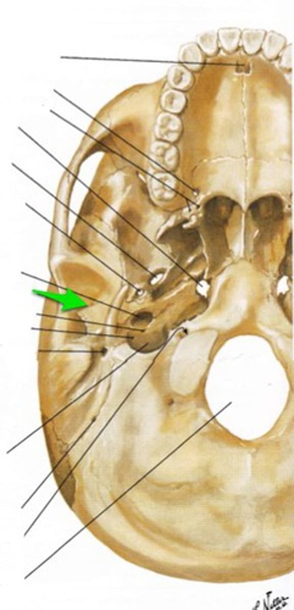 <p>the afferent fibers of facial n (CNVII) exit the skull through the _____</p>