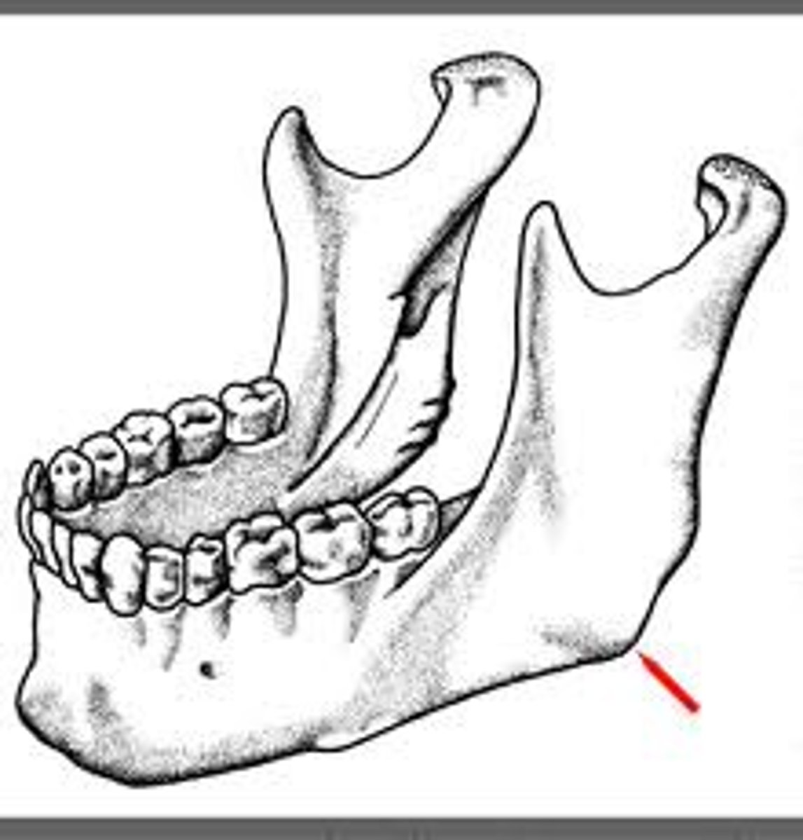 <p>Gonion</p>