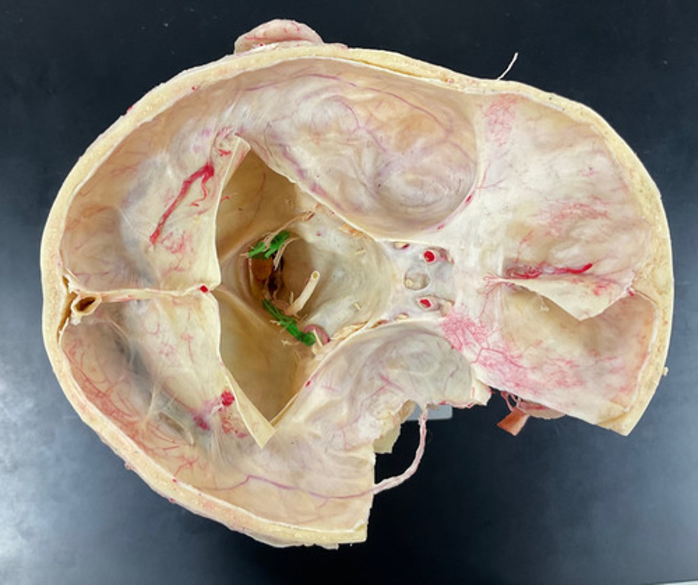 knowt flashcard image