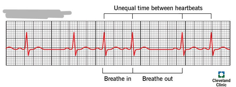 <p>What rhythm is this?</p>