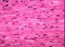 <ul><li><p><span style="background-color: transparent; font-family: "Book Antiqua", serif;"><span>In heart ONLY</span></span></p></li><li><p><span style="background-color: transparent; font-family: "Book Antiqua", serif;"><span>Autorhythmic cells  -Autonomic Nervous System plays a role (sleep vs. exercise).</span></span></p></li><li><p><span style="background-color: transparent; font-family: "Book Antiqua", serif;"><span>Striations not as distinct</span></span></p></li><li><p><span style="background-color: transparent; font-family: "Book Antiqua", serif;"><span>Branched cells with 1 nucleus</span></span></p></li><li><p><span style="background-color: transparent; font-family: "Book Antiqua", serif;"><em><span>Intercalated discs </span></em><span>strengthen the connection between cells</span></span></p></li><li><p><span style="background-color: transparent; font-family: "Book Antiqua", serif;"><span>Do </span><em><span>not</span></em><span> require nervous stimulation</span></span></p></li><li><p><span style="background-color: transparent; font-family: "Book Antiqua", serif;"><span>Autonomic nervous system can change the pace</span></span></p></li></ul><p></p>