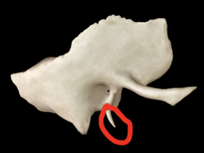 <p>What part of the temporal bone is this?</p>