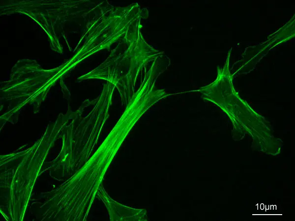 <ul><li><p><strong>fine strands of</strong> globular protein <strong><em>actin</em></strong></p></li><li><p><strong>bind with other proteins to hold organelles in place</strong></p></li><li><p><strong>interactions with another protein will</strong> bring about <strong>move</strong>ment of <strong>the cytoplasm and the cell as a whole</strong></p></li></ul>