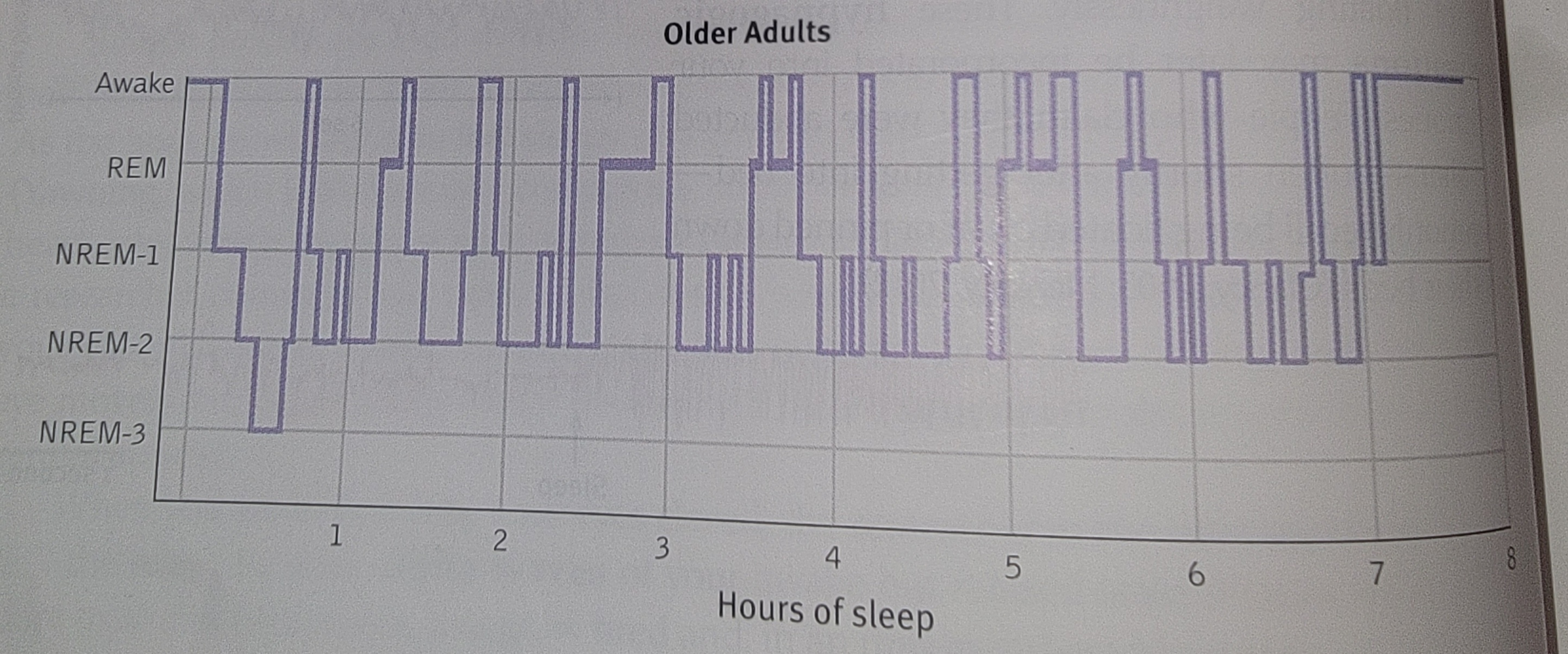 <p>picture +tip- A common mistake is that REM comes directly after NREM-3 sleep. It does NOT. Generally, NREM-2 follows NREM-3. Then comes REM</p>