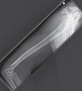 <p>name the position/projection</p>