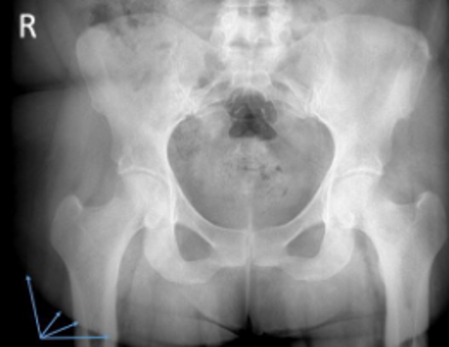 <p>What are the arrows pointing to?</p>