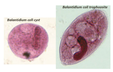 <p>Balantidium coli</p>