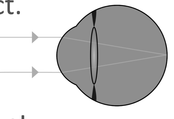 <ul><li><p><span>Ciliary muscles relax.</span></p></li><li><p><span>Suspensory ligaments tighten.</span></p></li><li><p><span>Lens is pulled thin.</span></p></li></ul><p>This is to refract light weakly. </p><p>Almost parallel rays. </p>