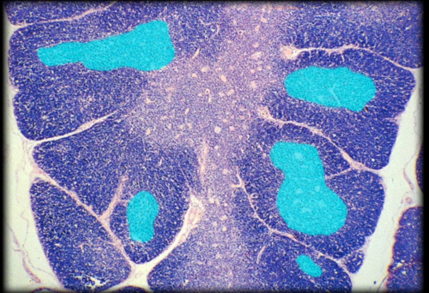 <p>Fetal thymus</p>