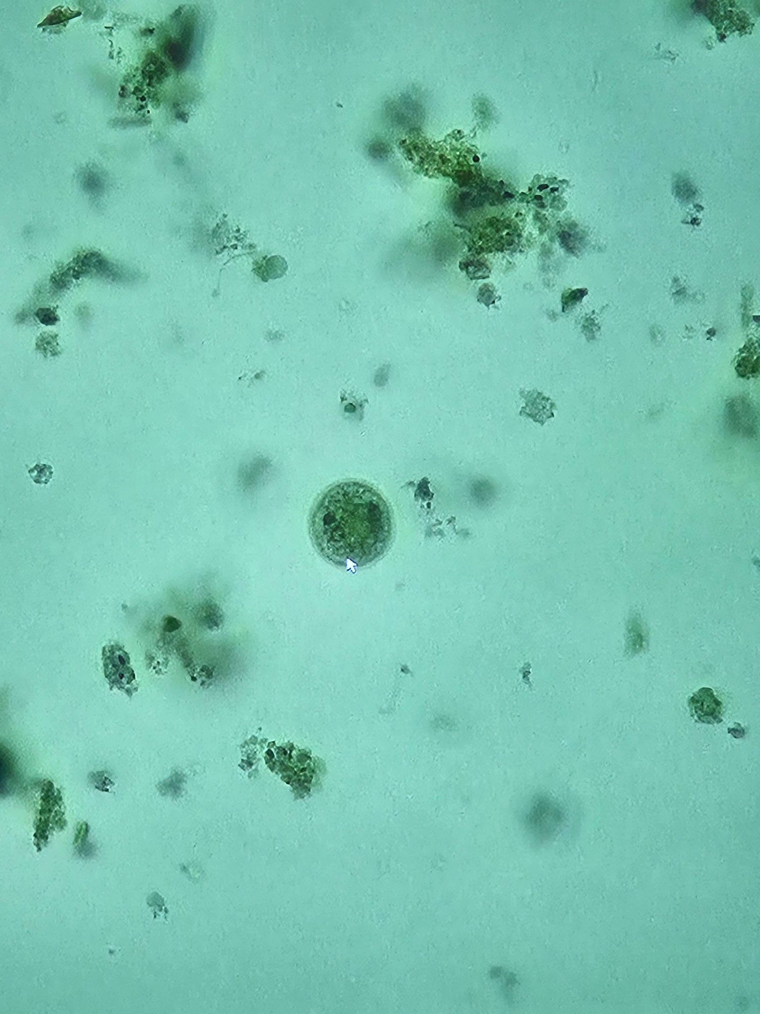 <p><span data-name="microscope" data-type="emoji">🔬</span><span data-name="petri_dish" data-type="emoji">🧫</span><strong><span> </span>Na podstawie zdjęcia preparatu:</strong></p><p></p><ul><li><p><span data-name="book" data-type="emoji">📖</span><span> </span>rozpoznaj gatunek pasożyta;</p></li></ul><p></p><ul><li><p><span data-name="recycle" data-type="emoji">♻</span><span> </span>rozpoznaj wszystkie formy rozwojowe;</p></li></ul><p></p><ul><li><p><span data-name="microbe" data-type="emoji">🦠</span><span> </span>wskaż organelle i cechy charakterystyczne dla danego gatunku;</p></li></ul><p></p><ul><li><p><span data-name="mask" data-type="emoji">😷</span><span> </span>nazwij chorobę, którą pasożyt wywołuje.</p></li></ul><p></p>