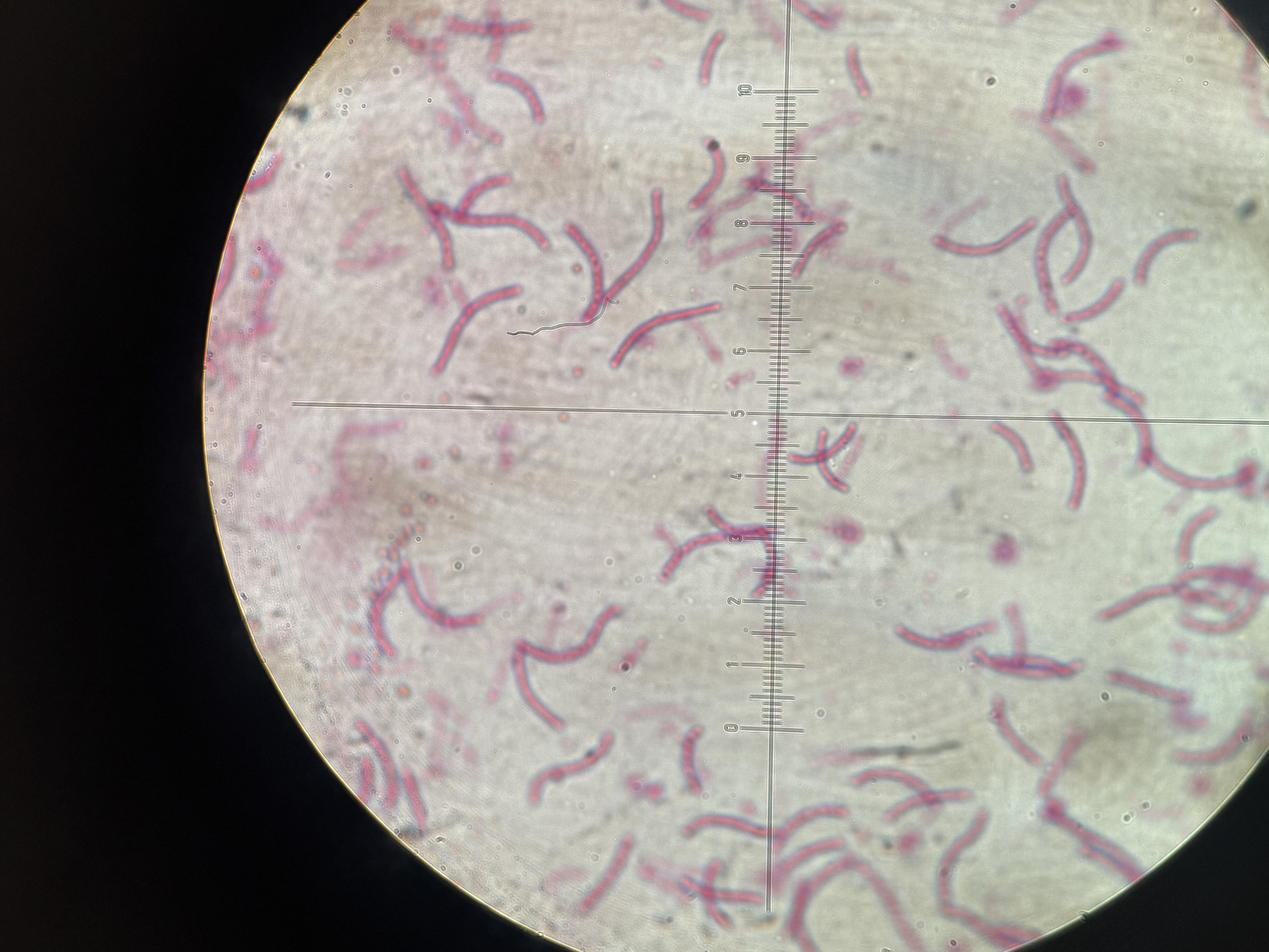 <p>Spirillum volutans</p>
