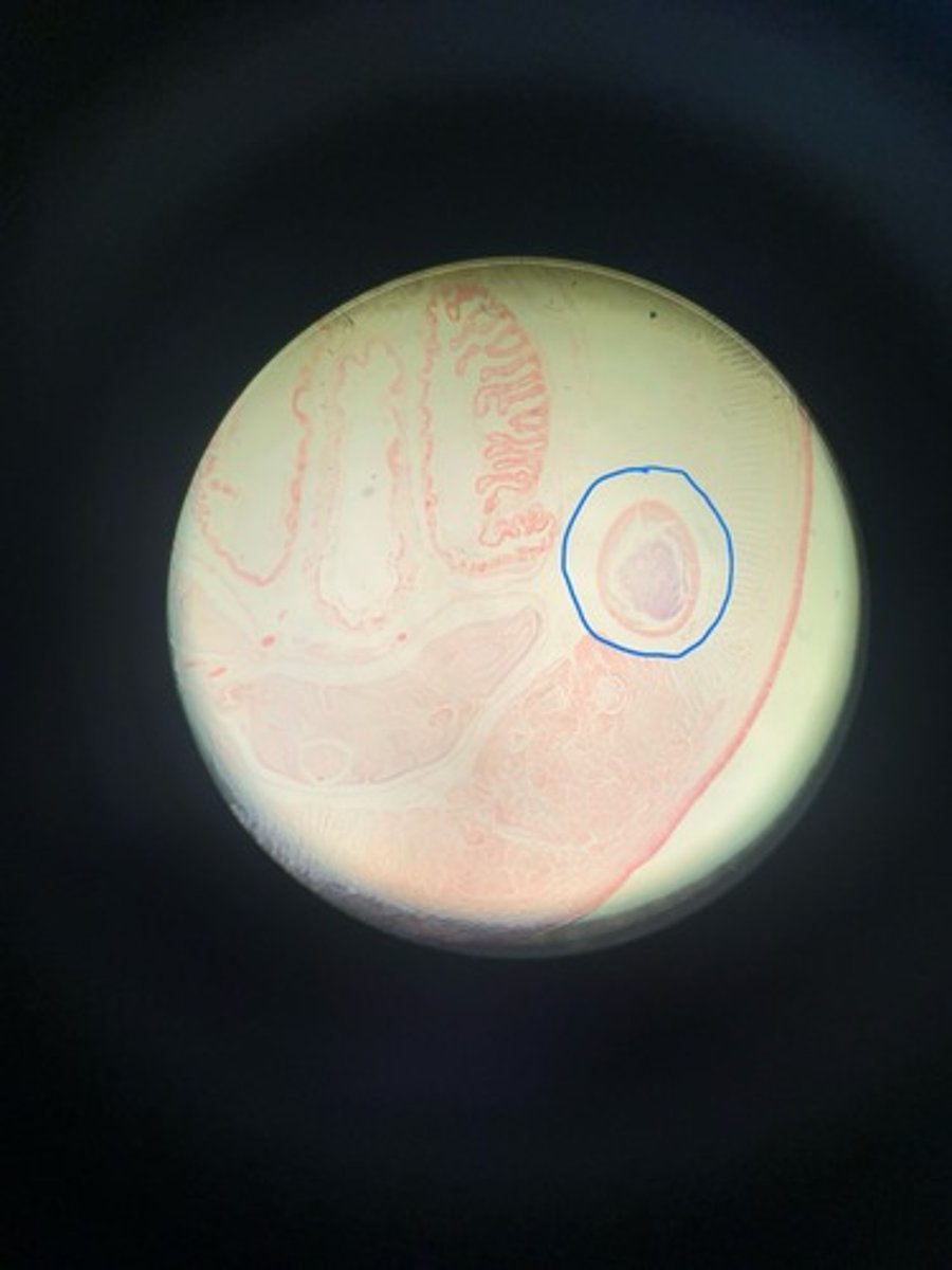 <p>What is the circled structure? What organism is this found in?</p>