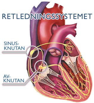 Retledningssystemet
